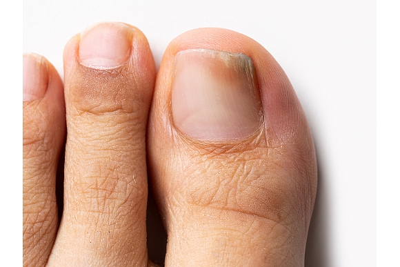 Autors: shutterstock.com