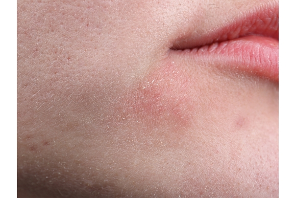 Autors: shutterstock.com