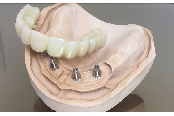 Zobu tehniskā laboratorija. SIA "Dentālā studija"