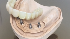 Zobu tehniskā laboratorija. SIA "Dentālā studija"